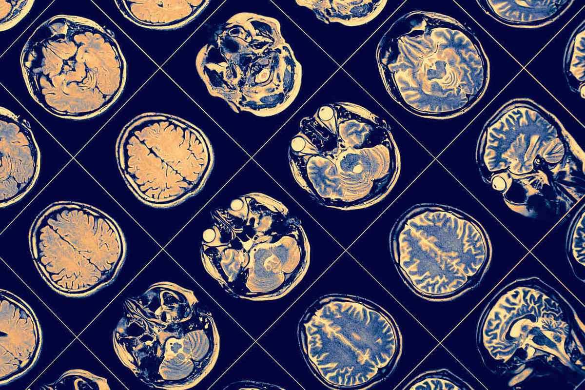 high-school research neuroscience neuroplasticity