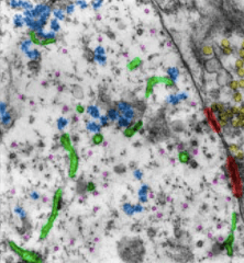 ribosome