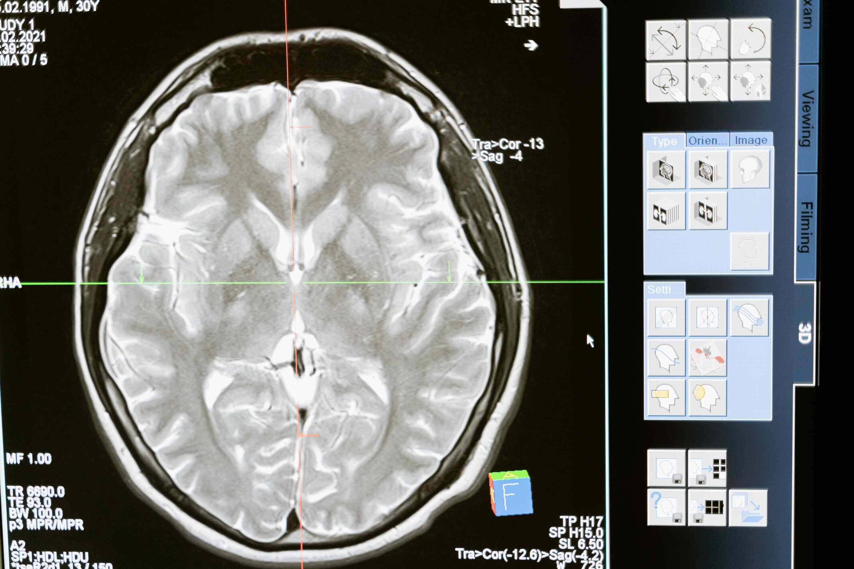 brain scan images